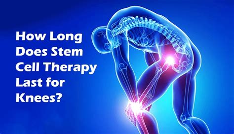 Stem Cell Therapy For Knees