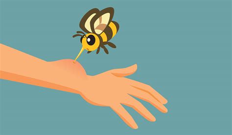 Sting Of A Bee