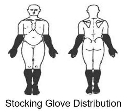 Stocking Glove Neuropathy