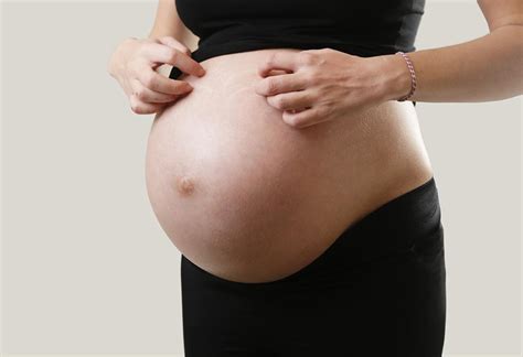 Stomach Itching While Pregnant