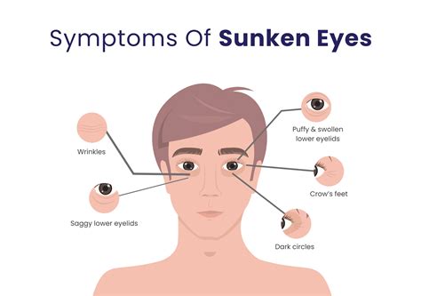 Sunken In Eyes