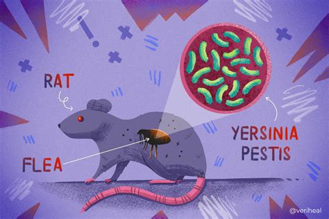 Treatment For Yersinia Pestis