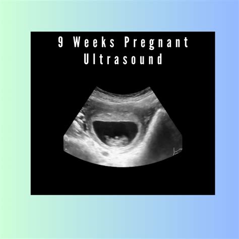 Ultrasound Week 9 Pregnancy