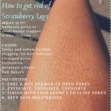 What Are Strawberry Legs