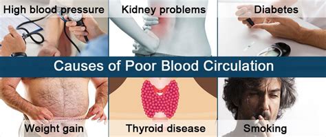 What Causes Poor Blood Circulation