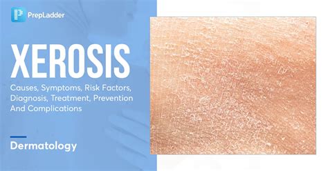 What Causes Xerosis