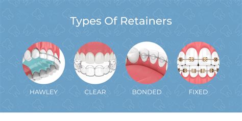 What Do Retainers Do