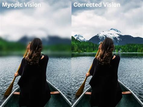 What Does Look Like Myopia