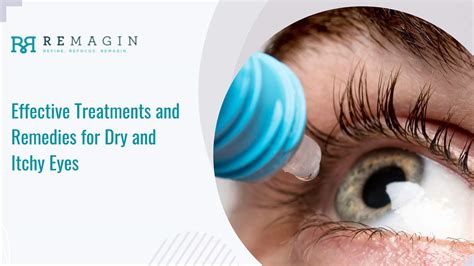 What Improves Dry Eyes