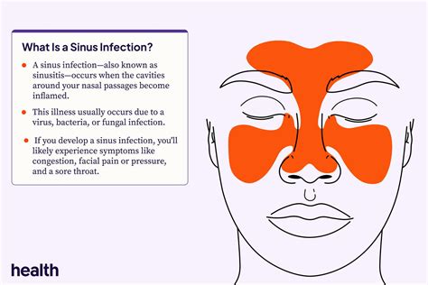 What Is A Sinus Infection