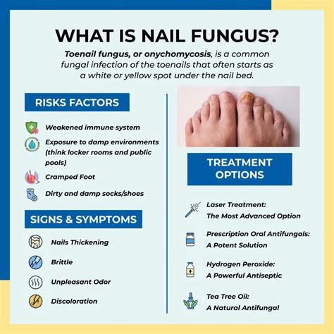 What Kills Toenail Fungus
