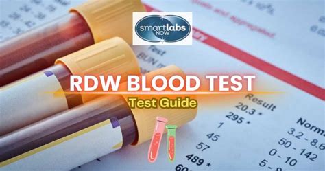 Whats Rdw In Blood Test