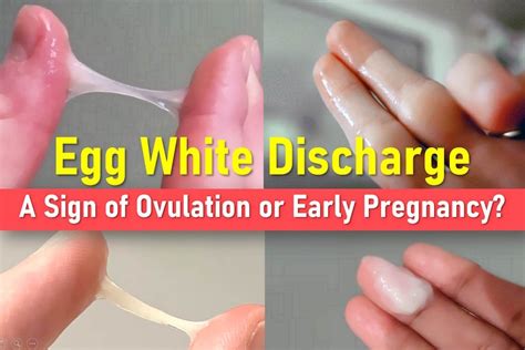 White Egg White Discharge