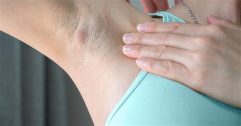Why Does My Armpit Itch