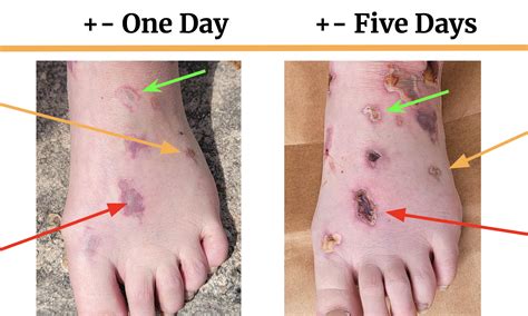 Why Does Xylazine Cause Wounds