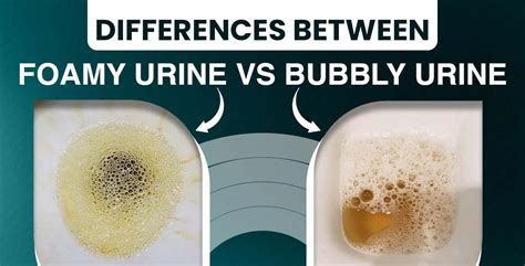 Why Is My Pee Bubbly